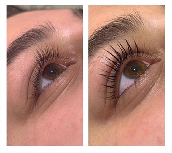 Center Güzellik Merkezi & Solaryum 