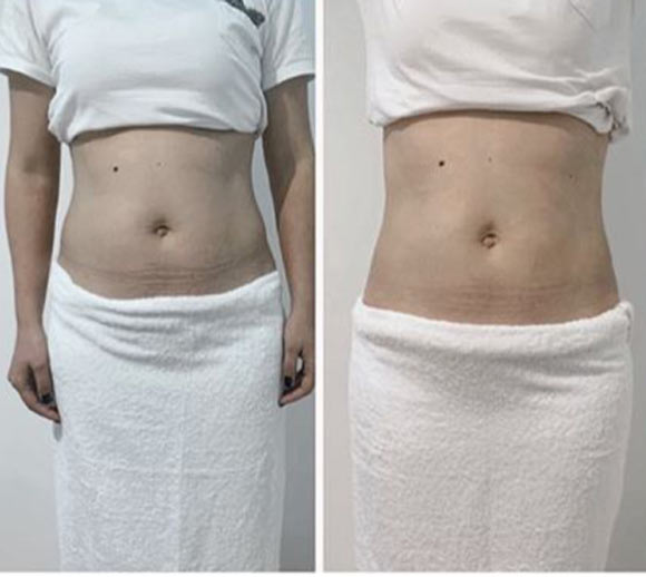 Center Güzellik Merkezi & Solaryum 